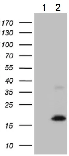 Western blot - Anti-MGP antibody [OTI8D6] - BSA and Azide free (AB273657)
