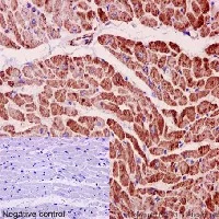 nutri west complete glutathione Glutathione S-transferases in kidney and urinary bladder tumors