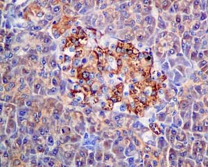 Immunohistochemistry (Formalin/PFA-fixed paraffin-embedded sections) - Anti-MGT4A antibody [EPR10034] (AB151750), expandable thumbnail