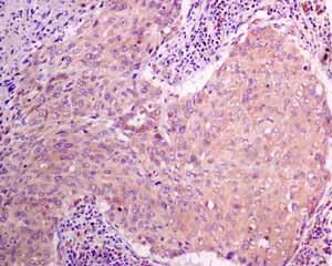 Immunohistochemistry (Formalin/PFA-fixed paraffin-embedded sections) - Anti-MGT4A antibody [EPR10034] (ab151750), expandable thumbnail