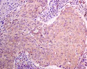 Immunohistochemistry (Formalin/PFA-fixed paraffin-embedded sections) - Anti-MGT4A antibody [EPR10034] (AB151750)