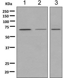 Western blot - Anti-MGT4A antibody [EPR10034] (AB151750), expandable thumbnail