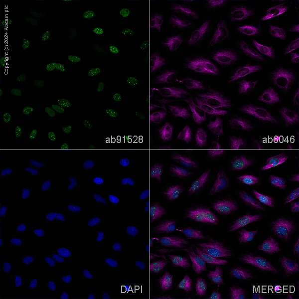 Immunocytochemistry/ Immunofluorescence - Anti-mH2A1 antibody [14G7] (AB91528)