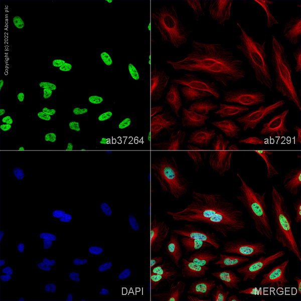 Immunocytochemistry/ Immunofluorescence - Anti-mH2A1 antibody (AB37264), expandable thumbnail