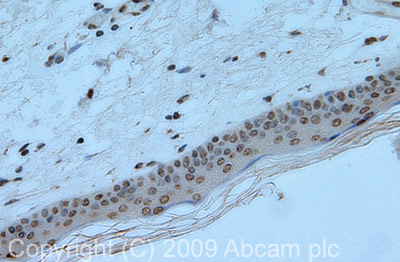 Immunohistochemistry (Formalin/PFA-fixed paraffin-embedded sections) - Anti-mH2A1 antibody (AB37264), expandable thumbnail
