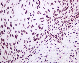 Immunohistochemistry (Formalin/PFA-fixed paraffin-embedded sections) - Anti-mH2A1 antibody [EPR9358] (AB137117), expandable thumbnail