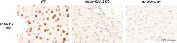 Immunohistochemistry (Formalin/PFA-fixed paraffin-embedded sections) - Anti-mH2A1 antibody [EPR9358] (AB137117), expandable thumbnail