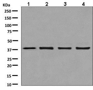 Western blot - Anti-mH2A1 antibody [EPR9358] (AB137117), expandable thumbnail