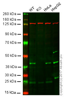 Western blot - Anti-mH2A1 antibody [EPR9358] (AB137117), expandable thumbnail