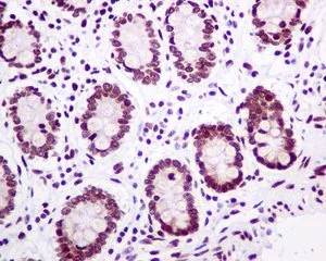 Immunohistochemistry (Formalin/PFA-fixed paraffin-embedded sections) - Anti-mH2A1 antibody [EPR9358] - BSA and Azide free (AB248830)