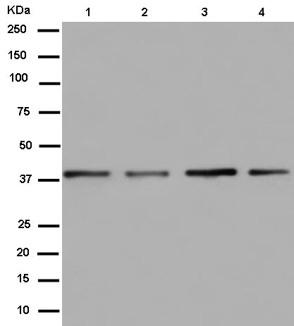 Western blot - Anti-mH2A1 antibody [EPR9359(2)] (AB183041)