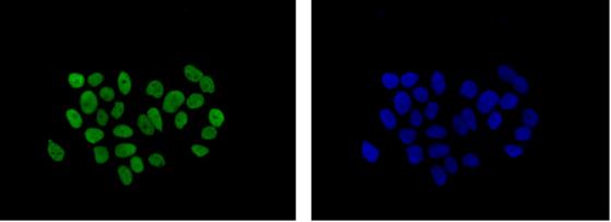 Immunocytochemistry/ Immunofluorescence - Anti-mH2A1 antibody [EPR9359(2)] - BSA and Azide free (AB232602), expandable thumbnail