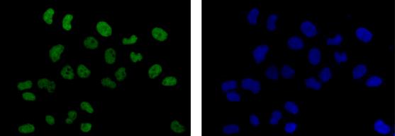 Immunocytochemistry/ Immunofluorescence - Anti-mH2A1 antibody [EPR9359(2)] - BSA and Azide free (AB232602), expandable thumbnail