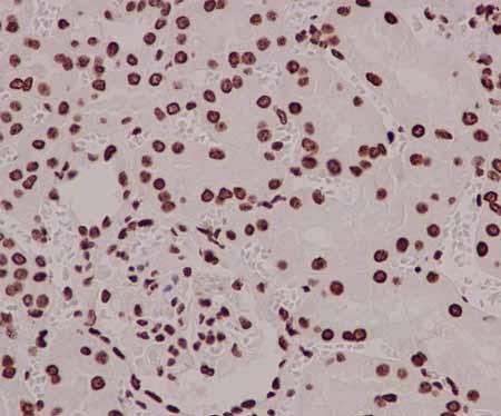 Immunohistochemistry (Formalin/PFA-fixed paraffin-embedded sections) - Anti-mH2A1 antibody [EPR9359(2)] - BSA and Azide free (ab232602), expandable thumbnail