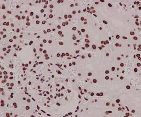 Immunohistochemistry (Formalin/PFA-fixed paraffin-embedded sections) - Anti-mH2A1 antibody [EPR9359(2)] - BSA and Azide free (AB232602)