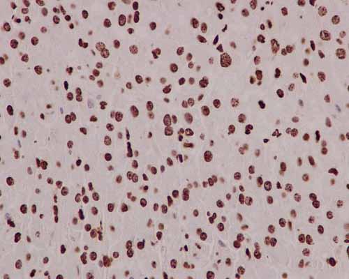 Immunohistochemistry (Formalin/PFA-fixed paraffin-embedded sections) - Anti-mH2A1 antibody [EPR9359(2)] - BSA and Azide free (AB232602), expandable thumbnail