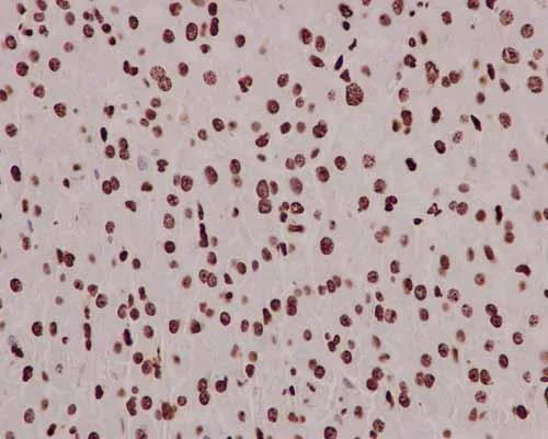 Immunohistochemistry (Formalin/PFA-fixed paraffin-embedded sections) - Anti-mH2A1 antibody [EPR9359(2)] - BSA and Azide free (AB232602)