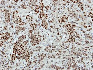 Immunohistochemistry (Formalin/PFA-fixed paraffin-embedded sections) - Anti-mH2A2 antibody (AB102126)
