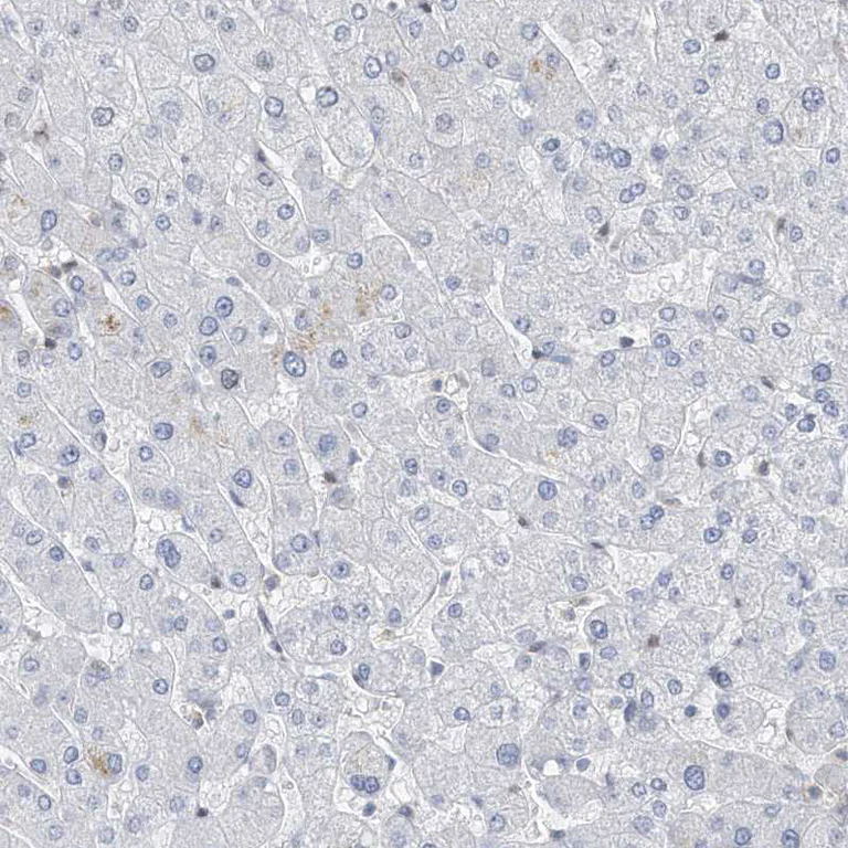 Immunohistochemistry (Formalin/PFA-fixed paraffin-embedded sections) - Anti-mH2A2 antibody (AB246995)