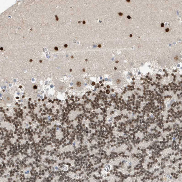 Immunohistochemistry (Formalin/PFA-fixed paraffin-embedded sections) - Anti-mH2A2 antibody (AB246995)