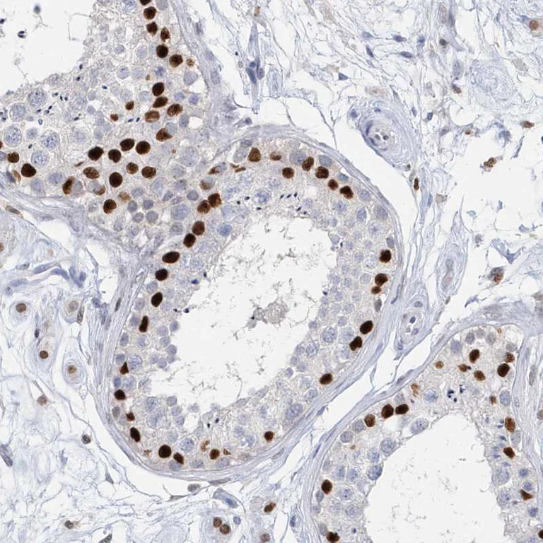 Immunohistochemistry (Formalin/PFA-fixed paraffin-embedded sections) - Anti-mH2A2 antibody (AB246995)