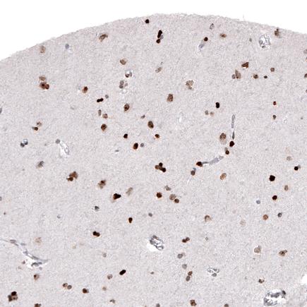 Immunohistochemistry (Formalin/PFA-fixed paraffin-embedded sections) - Anti-mH2A2 antibody [CL5263] (AB242357)