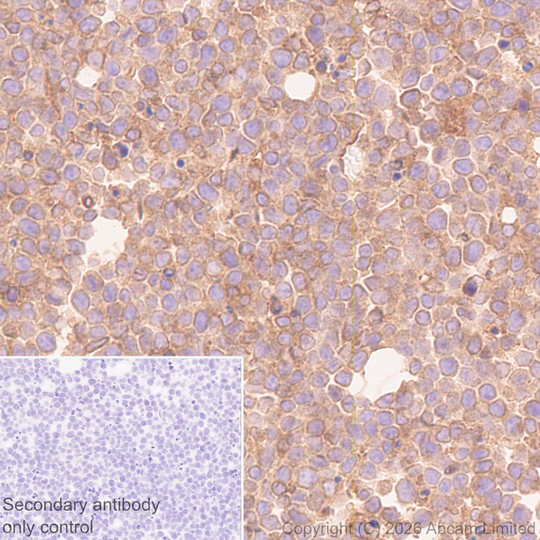 Immunohistochemistry (Formalin/PFA-fixed paraffin-embedded sections) - Anti-MHC Class 1 antibody [MJF-D30007-535] (AB326943)