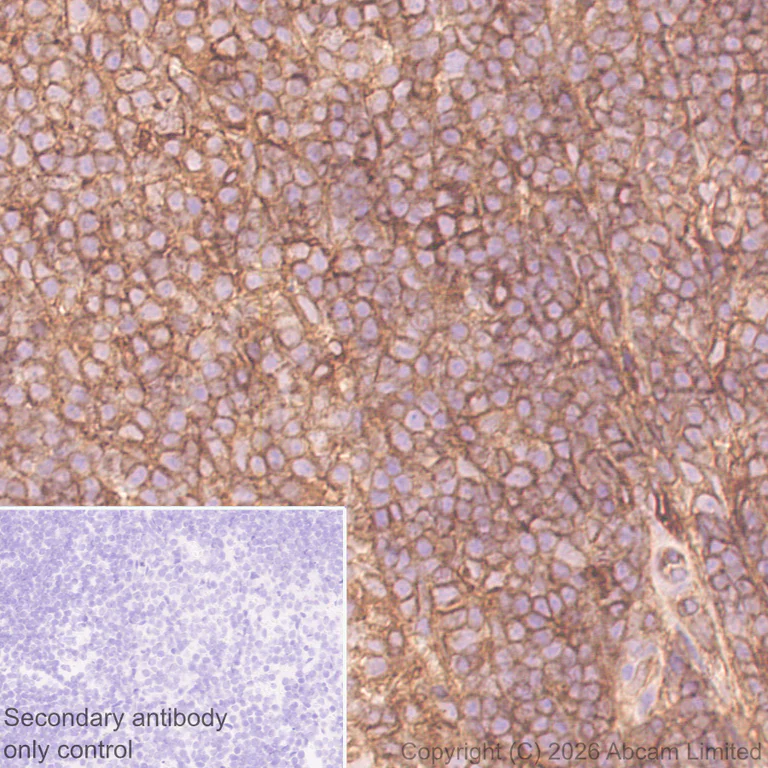 Immunohistochemistry (Formalin/PFA-fixed paraffin-embedded sections) - Anti-MHC Class 1 antibody [MJF-D30007-535] - BSA and Azide free (AB326950)
