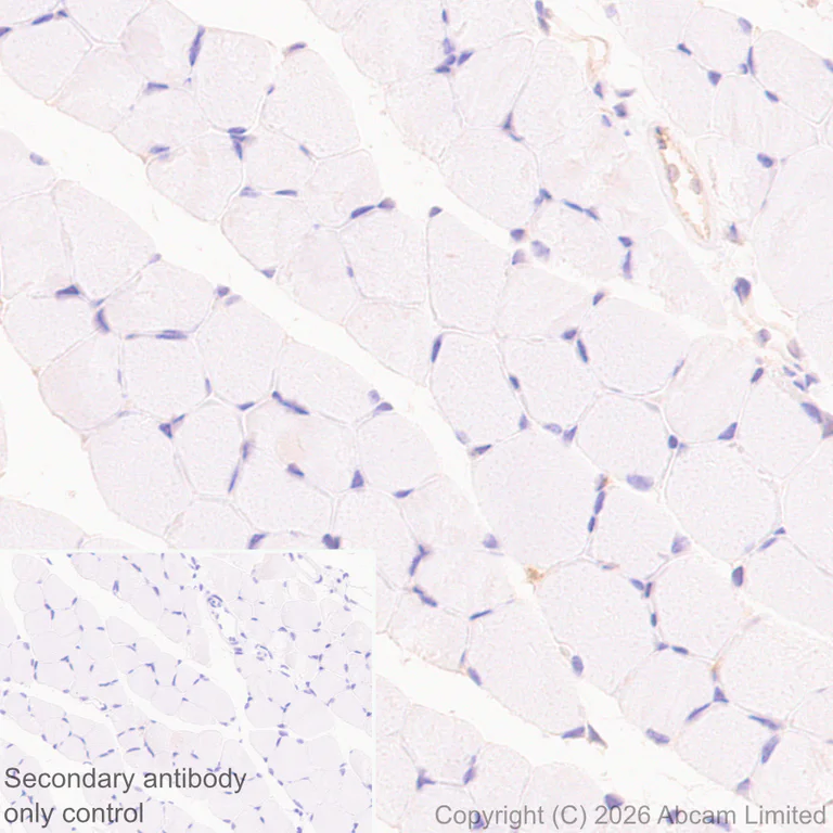 Immunohistochemistry (Formalin/PFA-fixed paraffin-embedded sections) - Anti-MHC Class 1 antibody [MJF-D30007-535] - BSA and Azide free (AB326950)