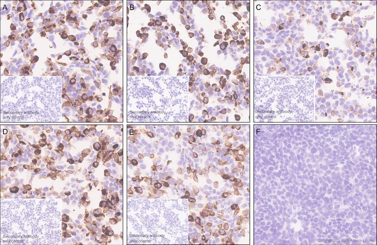 Immunohistochemistry (Formalin/PFA-fixed paraffin-embedded sections) - Anti-MHC Class 1 antibody [MJF-D30007-535] - BSA and Azide free (AB326950)