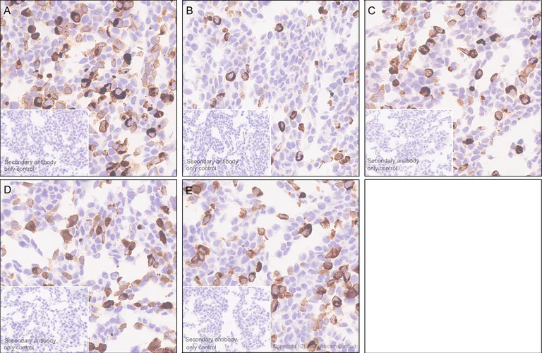 Immunohistochemistry (Formalin/PFA-fixed paraffin-embedded sections) - Anti-MHC Class 1 antibody [MJF-D30007-535] - BSA and Azide free (AB326950)
