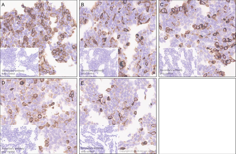 Immunohistochemistry (Formalin/PFA-fixed paraffin-embedded sections) - Anti-MHC Class 1 antibody [MJF-D30007-535] - BSA and Azide free (AB326950)