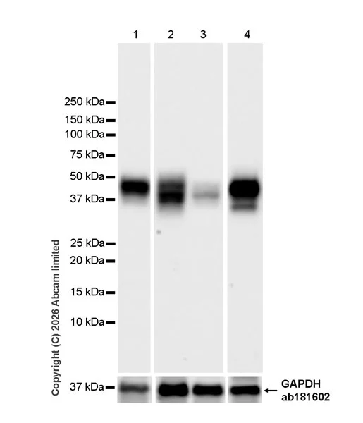 Western blot - Anti-MHC Class 1 antibody [MJF-D30007-535] - BSA and Azide free (AB326950)