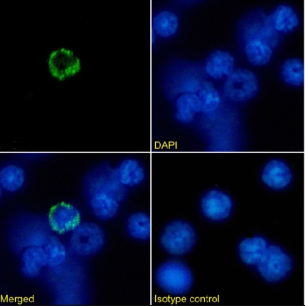 Immunocytochemistry/ Immunofluorescence - Anti-MHC class I antibody [R1-21.2] - Rabbit IgG (Chimeric) (AB281902)