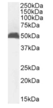 Western blot - Anti-MHC class I antibody [R1-21.2] - Rabbit IgG (Chimeric) (AB281902)