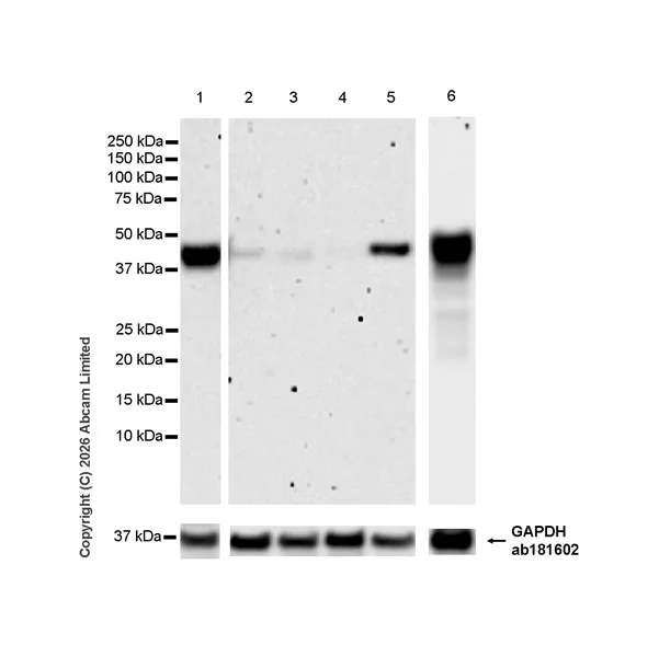 Western blot - Anti-MHC Class I H2-Kb antibody [MJF-D30006-601] (AB327061)