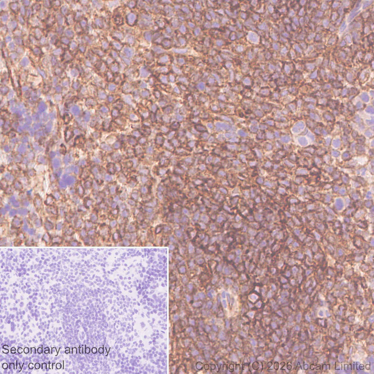 Immunohistochemistry (Formalin/PFA-fixed paraffin-embedded sections) - Anti-MHC Class I H2-Kb antibody [MJF-D30006-601] - BSA and Azide free (AB327065)
