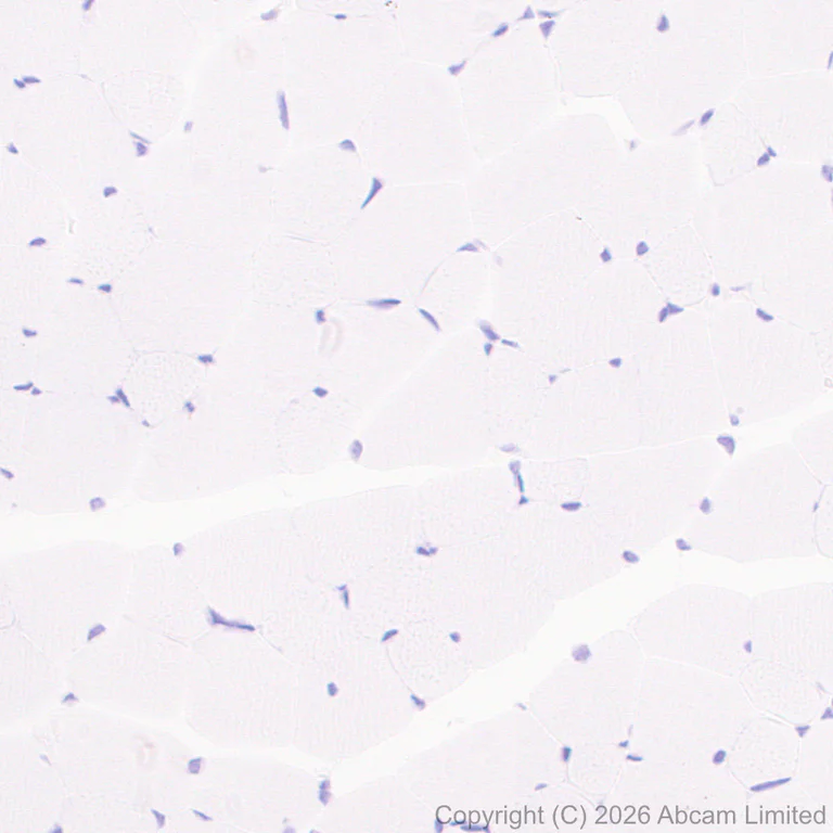 Immunohistochemistry (Formalin/PFA-fixed paraffin-embedded sections) - Anti-MHC Class I H2-Kb antibody [MJF-D30006-601] - BSA and Azide free (AB327065)