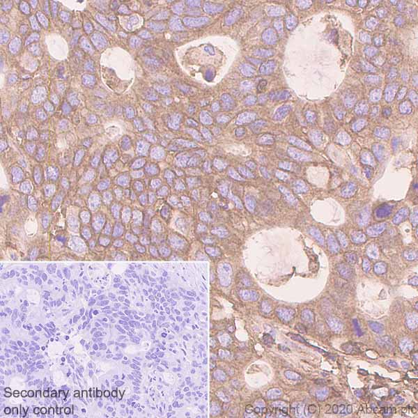 Immunohistochemistry (Formalin/PFA-fixed paraffin-embedded sections) - Anti-MHC class I + HLA A + HLA B antibody [EPR1394Y] (AB134189), expandable thumbnail