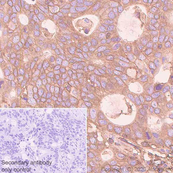 Immunohistochemistry (Formalin/PFA-fixed paraffin-embedded sections) - Anti-MHC class I + HLA A + HLA B antibody [EPR1394Y] (AB134189)