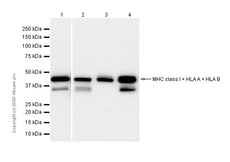 Western blot - Anti-MHC class I + HLA A + HLA B antibody [EPR1394Y] - BSA and Azide free (AB240087)