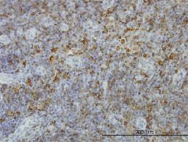 Immunohistochemistry (Formalin/PFA-fixed paraffin-embedded sections) - Anti-MHC Class II antibody [6C6] (AB55152)