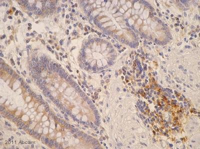 Immunohistochemistry (Formalin/PFA-fixed paraffin-embedded sections) - Anti-MHC Class II antibody [6C6] (AB55152)