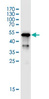 Western blot - Anti-MHC Class II antibody [6C6] (AB55152)