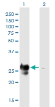 Western blot - Anti-MHC Class II antibody [6C6] (AB55152)