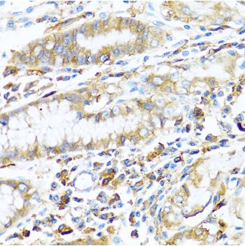 Immunohistochemistry (Formalin/PFA-fixed paraffin-embedded sections) - Anti-MHC Class II antibody (AB180779)