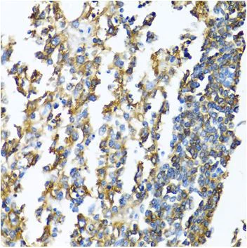 Immunohistochemistry (Formalin/PFA-fixed paraffin-embedded sections) - Anti-MHC Class II antibody (AB180779)