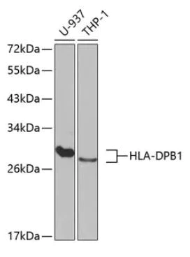 Western blot - Anti-MHC Class II antibody (AB180779)