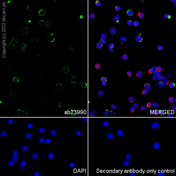 Immunocytochemistry/ Immunofluorescence - Anti-MHC Class II antibody [MRC OX-6] - BSA and Azide free (AB237959), expandable thumbnail