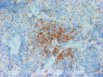 Immunohistochemistry (Formalin/PFA-fixed paraffin-embedded sections) - Anti-MHC Class II antibody [MRC OX-6] - BSA and Azide free (AB237959), expandable thumbnail